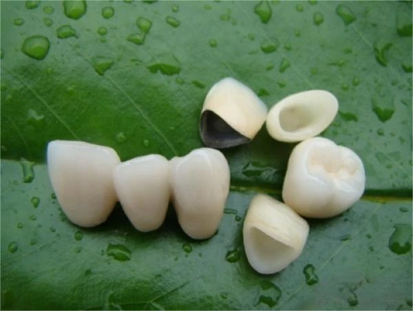 China Dental Lab: Zirconia Crown