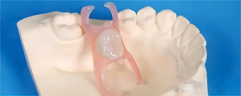 chinese dental laboratory:Flexible Denture