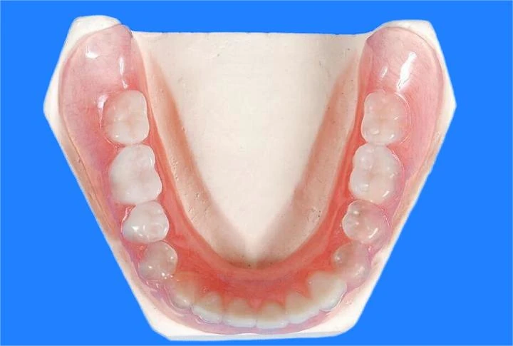 China Dental Lab:Flexible Denture