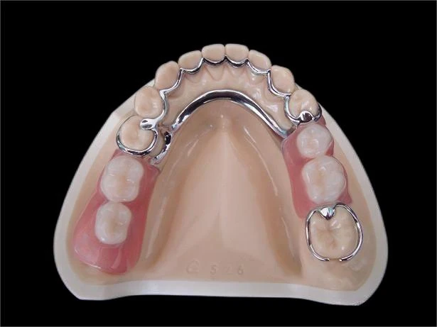 china dental lab:removable denture