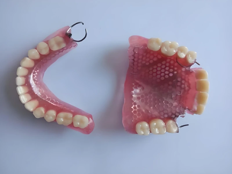 china dental laboratory:removable denture